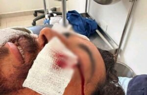 Investigan incidente en Sisal que dejó a pescador hospitalizado; señalan presunta participación de funcionario municipal