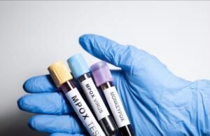 Yucatán confirma nuevos casos de Mpox y se mantiene como la segunda entidad con mayor incidencia en el país