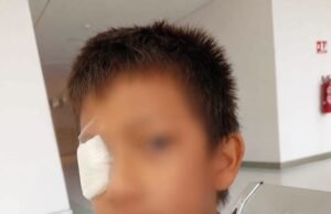 Madre denuncia presunta falta de mantenimiento tras accidente que dejó lesionado a un menor en parque de Maxcanú