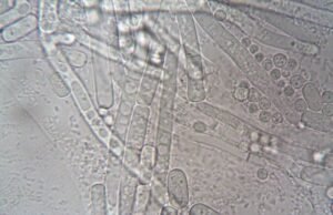 Salud confirma 33 casos de ciclosporiasis en México; descartan evidencia de que el brote en EE.UU. se originara en el país